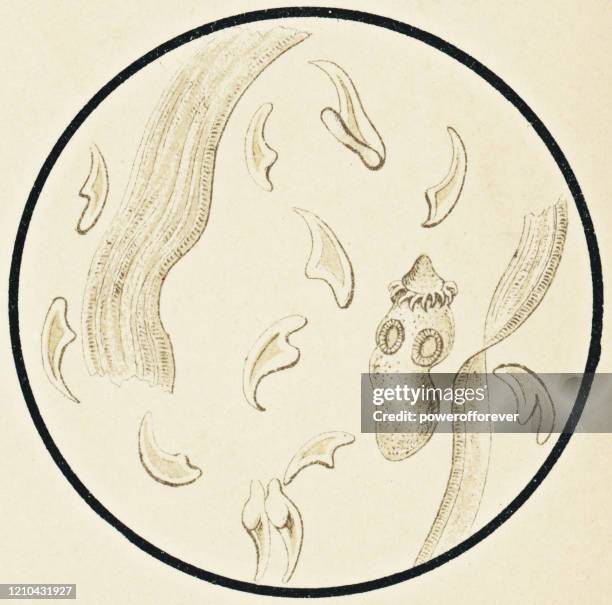 ilustraciones, imágenes clip art, dibujos animados e iconos de stock de vista microscópica de piezas de tenia en un quiste hidatídico de un paciente con equinococosis - siglo xix - cyst