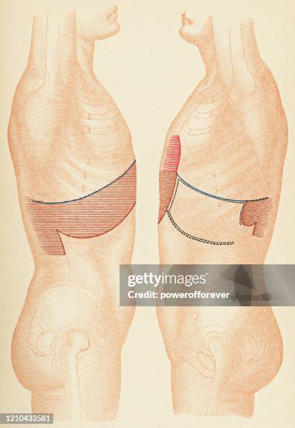 illustrations, cliparts, dessins animés et icônes de illustration médicale du torse humain avec des points de percussion, vue de côté - 19ème siècle - modèle anatomique