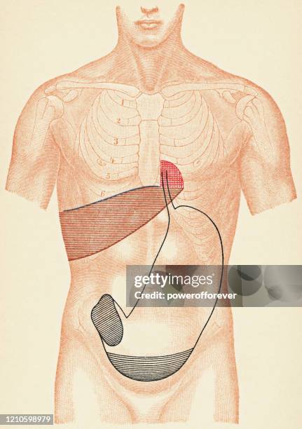 medical illustration of human torso with percussion exam points for a patient with stomach cancer and pyloric stenosis, front view - 19th century - digestive system model stock illustrations
