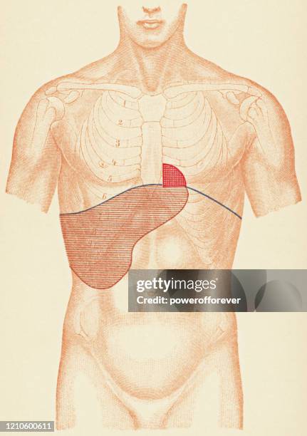 肝臓腫瘍患者のパーカッション試験ポイントを有�するヒト胴体の医療イラスト、フロントビュー - 19世紀 - 打楽器点のイラスト素材／クリップアート素材／マンガ素材／アイコン素材