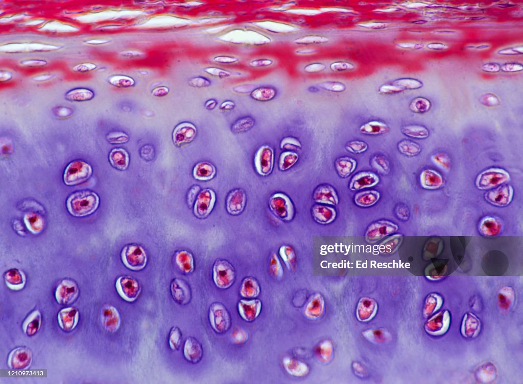 Hyaline Inclusions Hyaline Cartilage Connective Tissue Trachea