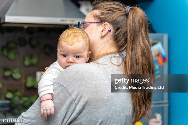 madre sosteniendo cabeza de bebé recién nacido con problema dermatológico cradle cap dermatitis seborreica - dermatitis seborreica fotografías e imágenes de stock