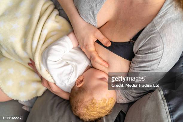 baby boy with dermatologic problem cradle cap seborrheic dermatitis eating from mum's breast breastfeeding - seborrheic dermatitis stock pictures, royalty-free photos & images