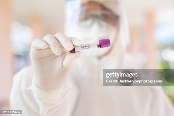 asian male doctor holding covid-19 blood sample on white background - covid 2019 stock pictures, royalty-free photos & images