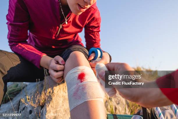 injured woman being treated during hiking - bloody leg stock pictures, royalty-free photos & images