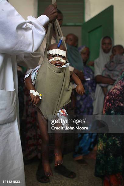 Nurse weighs a sick and malnourished child at the Banadir hospital on August 14, 2011 in Mogadishu, Somalia. The US government estimates that some...