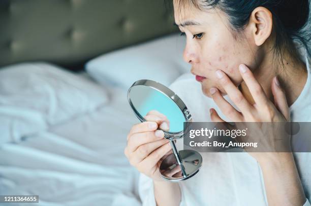 close up of asian woman worry about her face when she saw the problem of acne and scar by the mini mirror. - adult acne stock pictures, royalty-free photos & images