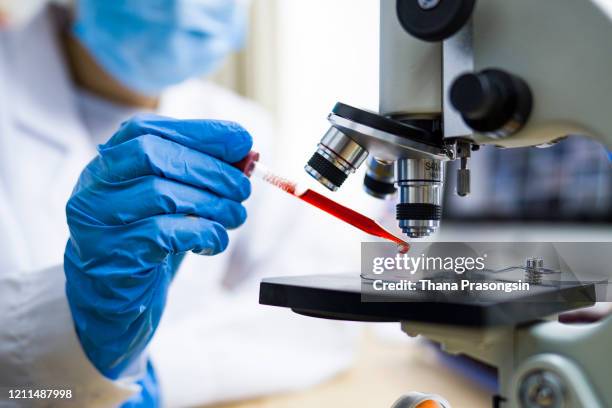 scientist working with blood sample in laboratory - red tube stock-fotos und bilder
