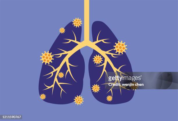 virus infects lungs stock illustration - bronchitis stock illustrations