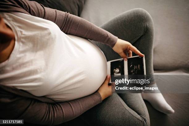 first picture of my baby - abdomen scan stock pictures, royalty-free photos & images