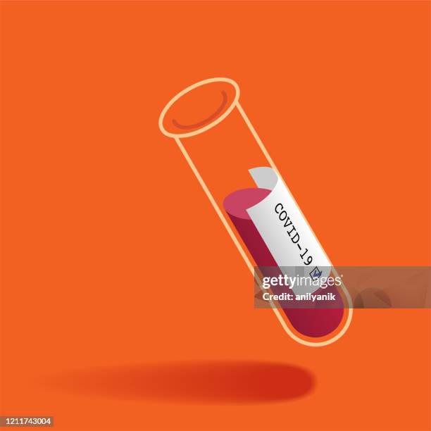 stockillustraties, clipart, cartoons en iconen met bloed met positief coronavirus resultaat. - medisch specimen