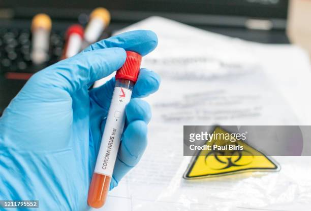 close up of microbiologist hand with surgical gloves holding a blood test tube for coronavirus. test tubes with blood sample for covid-19 virus, biohazard transportation bag - positive emotion stock pictures, royalty-free photos & images