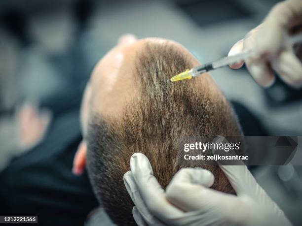 self serum skin therapy - hair treatment stock pictures, royalty-free photos & images