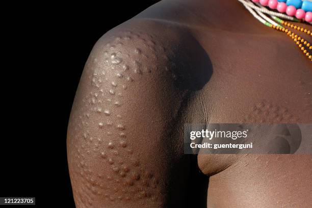 scar pattern on the body of a surma fighter - mursi tribe stock pictures, royalty-free photos & images