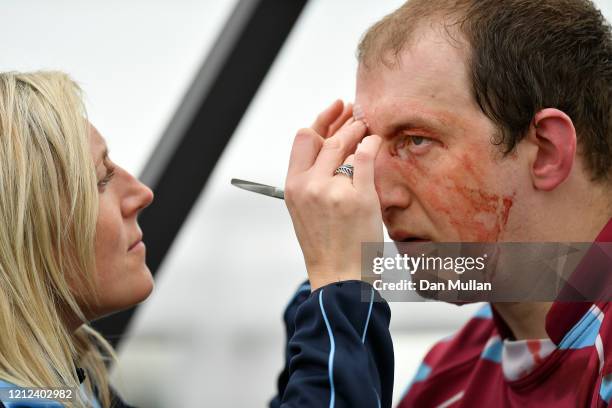 Mylo Connell of OPMs receives medical attention to a cut on his head during the Lockie Cup Semi Final match between Old Plymouthian and Mannameadians...