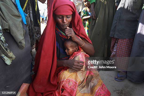 Mother holds her child, sick with measles, at a camp for Somalis displaced by famine and drought on August 16, 2011 in Mogadishu, Somalia. The U.S....