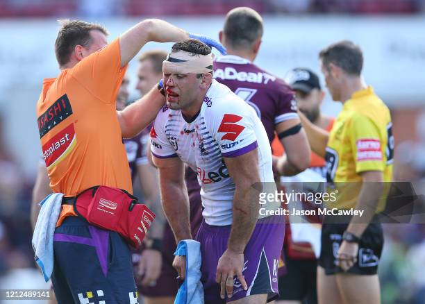 Dale Finucane of the Storm receives attention from the trainer during the round 1 NRL match between the Manly Sea Eagles and the Melbourne Storm at...