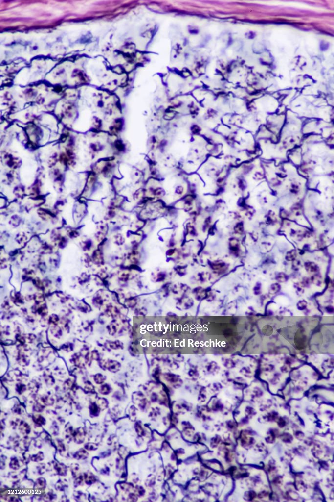 RETICULAR FIBERS in a LYMPH NODE, 100X