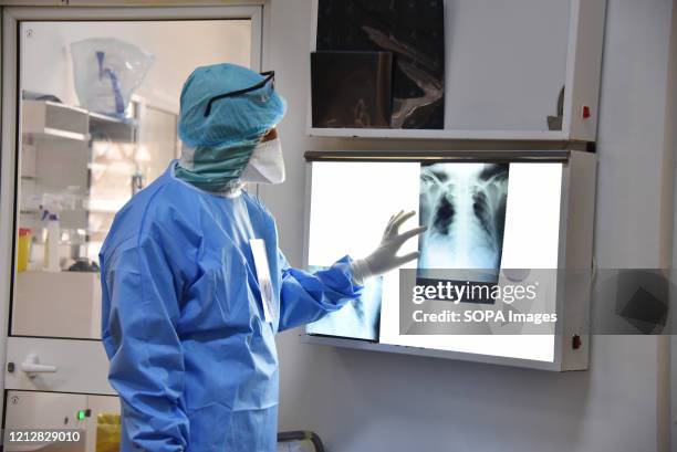 Medical worker conducts an x-ray on a patient during International Nurses Day at Abdel Rahman Mami Hospital, the central hospital for covid-19...