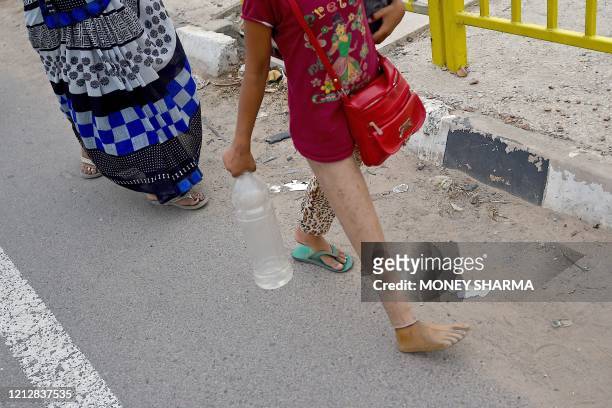 Girl with an artificial leg walks with her family of migrant workers towards their respective hometown states during a government-imposed nationwide...