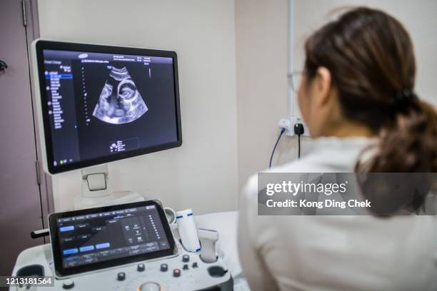 arzt untersucht schwangere frau im krankenhaus - baby monitor stock-fotos und bilder