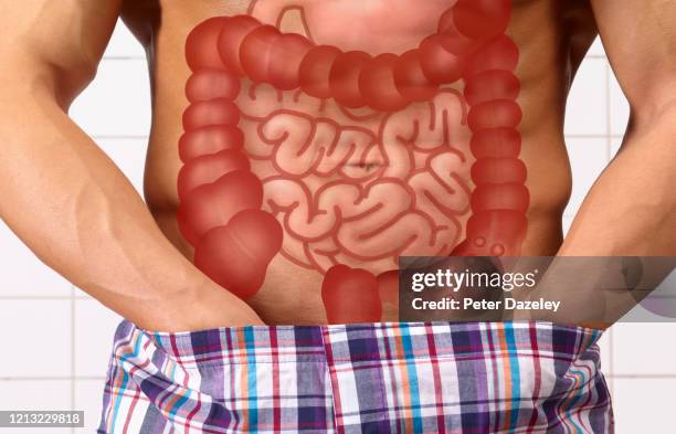 digitally generated image of man's inflammed large intestine. - colite foto e immagini stock