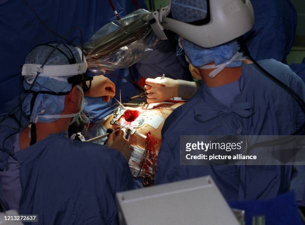 Professor Hermann Reichenspurner operiert am 28.5.1998 im Transplantationszentrum Großhadern der Universität München am offenen Herzen mit einem...
