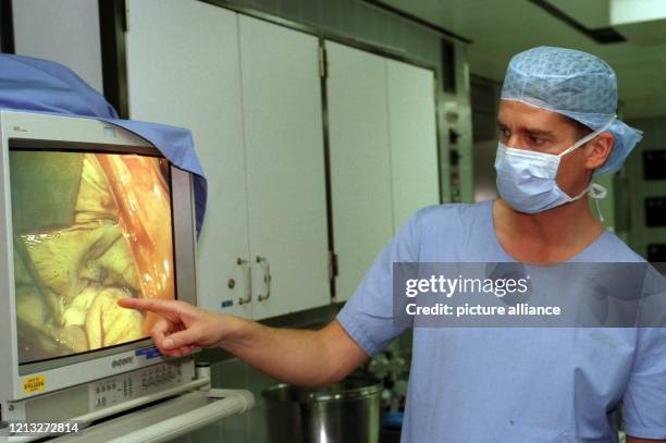 Professor Hermann Reichenspurner erklärt am 28.5.1998 im Transplantationszentrum Großhadern der Universität München auf dem Video-Bildschirm eine...