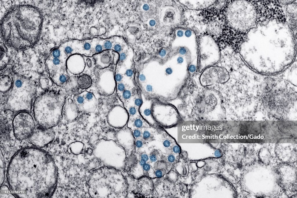 COVID-19 Coronavirus