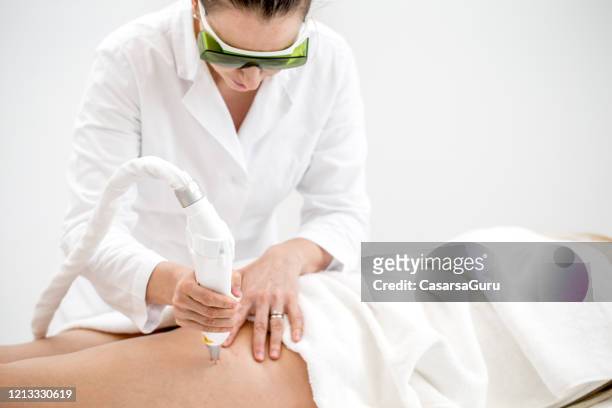 dermatologist removing vascular veins on woman's leg with laser treatment - stock photo - medical laser stock pictures, royalty-free photos & images