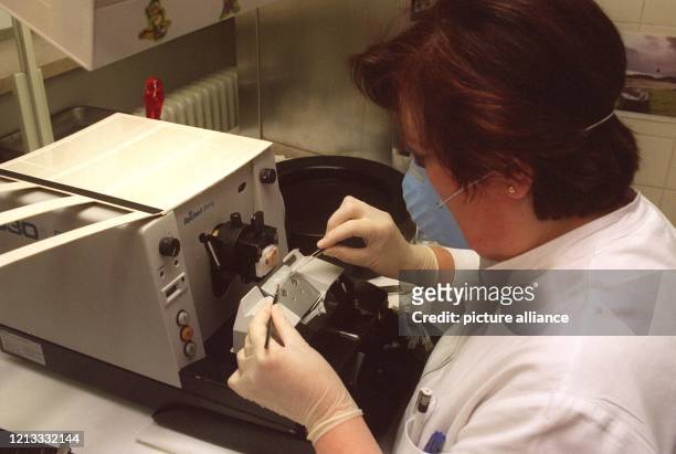 Eine Laborantin untersucht am 23.4.1996 im Landesuntersuchungsamt für das Gesundheitswesen in Nürnberg unterm Mikroskop Partikel eines aus England...
