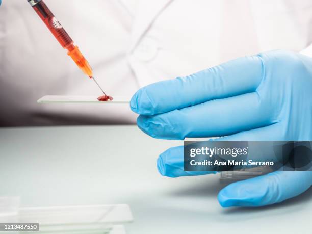 a female doctor or scientist analyzing a human blood sample - blood group stock-fotos und bilder