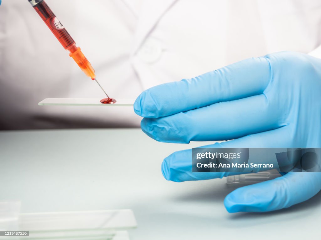 A female doctor or scientist analyzing a human blood sample