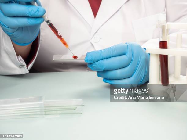 a female doctor or scientist analyzing a human blood sample - blood group - fotografias e filmes do acervo