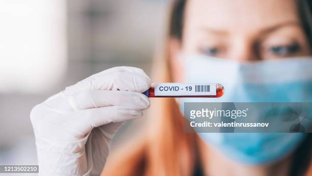 campione di sangue coronavirus - coronavirus test foto e immagini stock