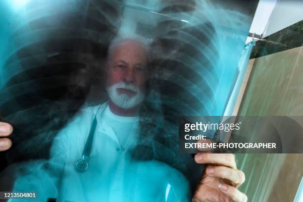 an epidemiologist seen through an x-ray image he's holding up of a coronavirus-infected patient - respiratory disease stock pictures, royalty-free photos & images