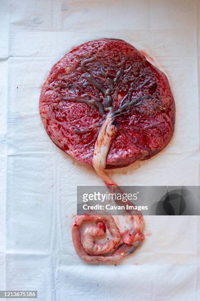 human placenta with veins and umbilical cord visible. - labor childbirth stock-fotos und bilder