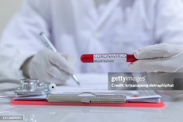 concept to represent the 2020 virus threat coronavirus, blood in a test tube. - crime or recreational drug or prison or legal trial stock-fotos und bilder