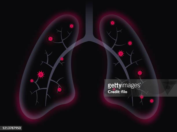 コロナウイルス covid-19 呼吸器性肺疾患 - 白血球点のイラスト素材／クリップアート素材／マンガ素材／アイコン素材