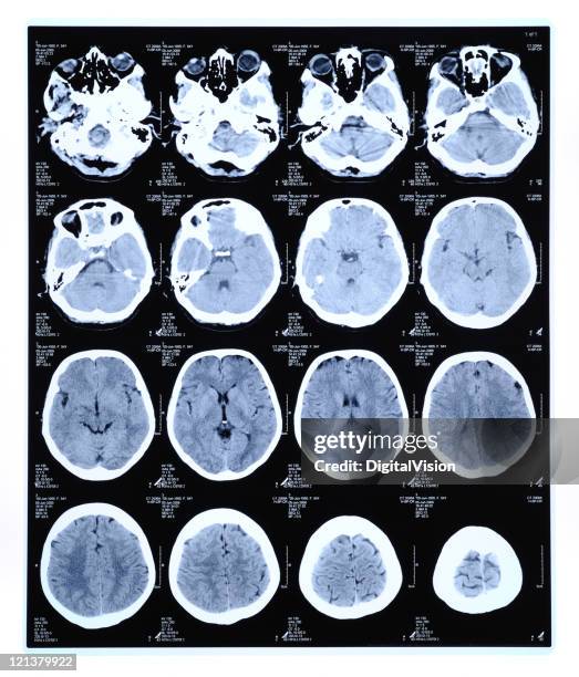 cat scan - medical scan stock pictures, royalty-free photos & images