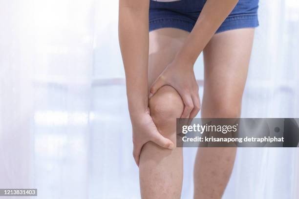 woman knee pain, leg pain - female knee pain stock-fotos und bilder