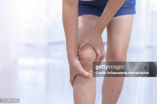 woman knee pain, leg pain - bone stock pictures, royalty-free photos & images