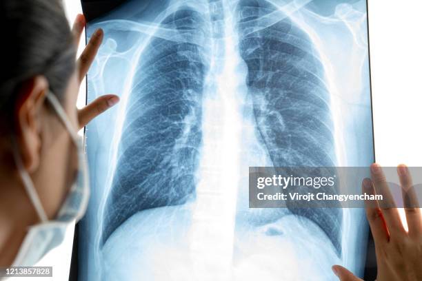 female doctor analyzing lung x ray film in the lab - breathing chest stock-fotos und bilder