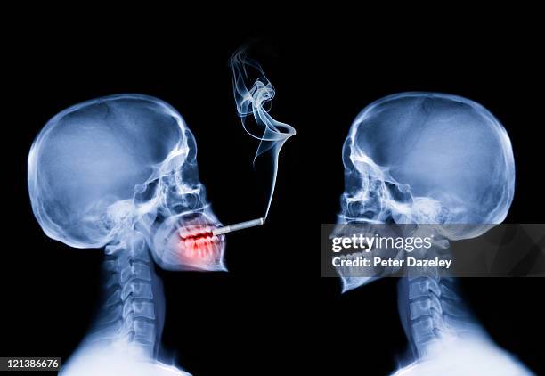 partner passive smoking - scientific imaging technique fotografías e imágenes de stock