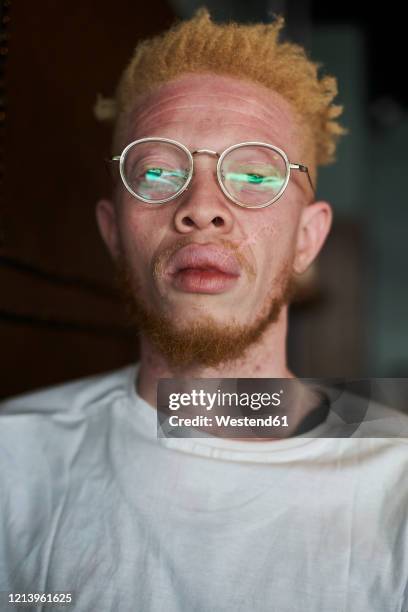 portrait of an albino man with round glasses - guy with scar stock pictures, royalty-free photos & images