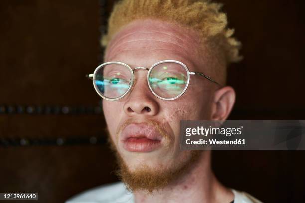 portrait of an albino man with round glasses - cicatriz imagens e fotografias de stock