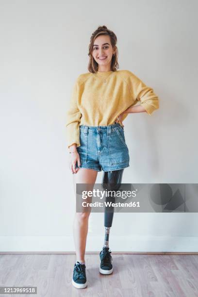 portrait of smiling young woman with leg prosthesis - equipo protésico fotografías e imágenes de stock