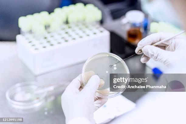 a microbiologist performs bacteriological testing in the laboratory - streptococcus stock-fotos und bilder