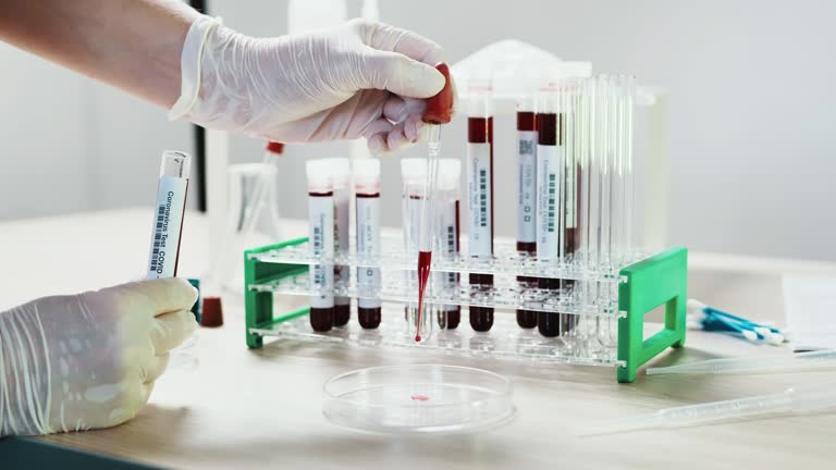 Laboratory Sampling Videos and HD Footage - Getty Images