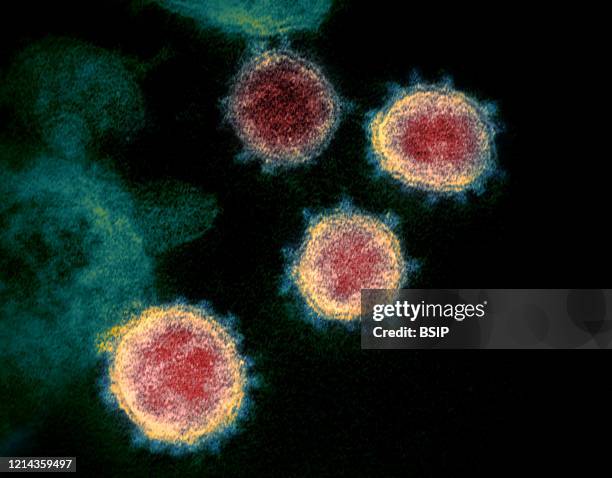 This transmission electron microscope image shows SARS-CoV-2-also known as 2019-nCoV, the virus that causes COVID-19-isolated from a patient in the...